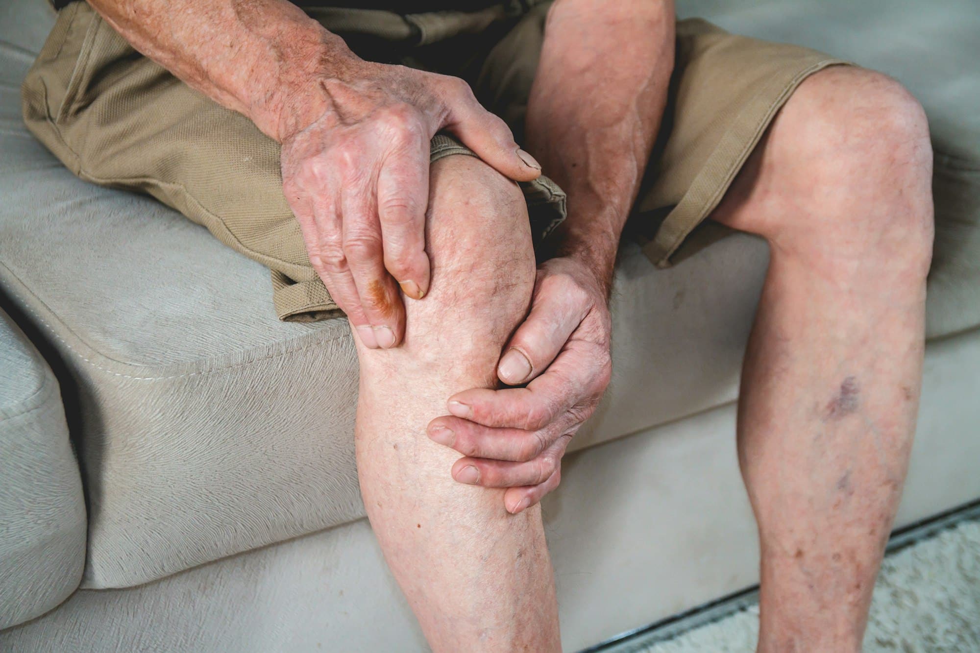 Spécialiste de l’arthrose du genou : les services qu’il peut vous offrir